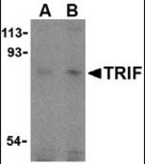Western blot of TRIF in human lung cell lysates with TRIF antibody at (A) 2 and (B) 4 g/ml.