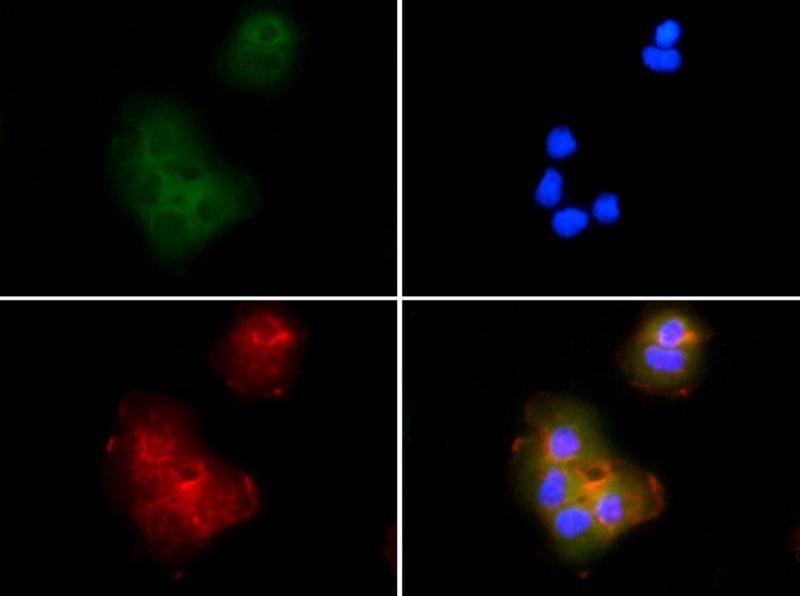 Immunocytochemistry/Immunofluorescence: ASC/TMS1 Antibody - ASC/TMS1 antibody was tested in A431 cells with FITC (green). Nuclei and alpha-tubulin were counterstained with DAPI (blue) and Dylight 594 (red).