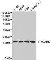 Western blot of PYCARD pAb in extracts from HL60, A549, Raji, Raw264.7 cells.
