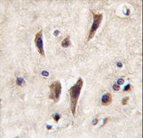 Formalin-fixed and paraffin-embedded human brain tissue reacted with TIE antibody , which was peroxidase-conjugated to the secondary antibody, followed by DAB staining. This data demonstrates the use of this antibody for immunohistochemistry; clinical relevance has not been evaluated.