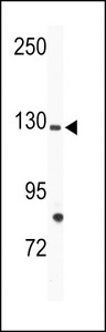 Western blot of anti-TIE Antibody in mouse bladder tissue lysates (35 ug/lane). TIE(arrow) was detected using the purified antibody.