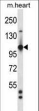Mouse Tie1 Antibody western blot of mouse heart tissue lysates (35 ug/lane). The Tie1 antibody detected the Tie1 protein (arrow).