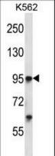 Mouse Tie1 Antibody western blot of K562 cell line lysates (35 ug/lane). The Tie1 antibody detected the Tie1 protein (arrow).