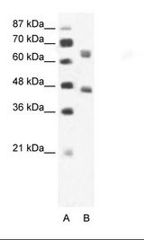 A: Marker, B: Jurkat Cell Lysate