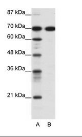 A: Marker, B: Jurkat Cell Lysate