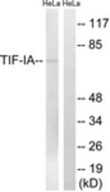Western blot of extracts from HeLa cells, treated with calyculin A 50 ng/ml 30', using TIF-IA (Ab-649) Antibody. The lane on the right is treated with the synthesized peptide.