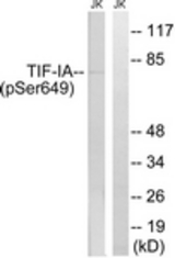 Western blot of extracts from Jurkat cells treated with starved 24h, using TIF-IA (Phospho-Ser649) Antibody. The lane on the right was incubated with synthetic peptide.