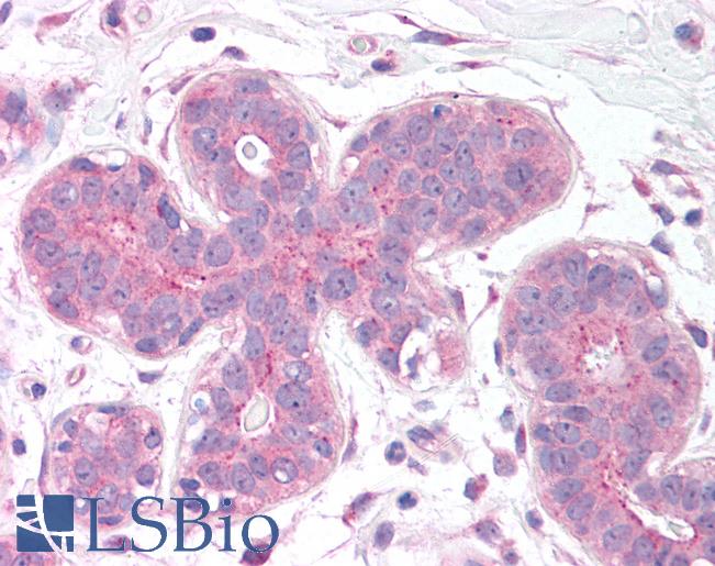 Anti-C12orf5 / TIGAR antibody IHC of human breast. Immunohistochemistry of formalin-fixed, paraffin-embedded tissue after heat-induced antigen retrieval. Antibody LS-B1341 concentration 5 ug/ml.