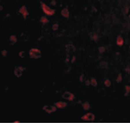 Immunofluorescence of TIGAR in Human Brain cells with TIGAR antibody at 20 ug/ml.