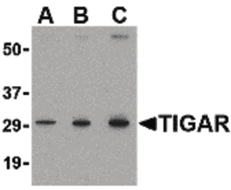 Western blot of TIGAR in MCF7 cell lysate with TIGAR antibody at (A) 0.5, (B) 1 and (C) 2 ug/ml.