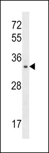 TIGAR Antibody western blot of mouse kidney tissue lysates (35 ug/lane). The TIGAR antibody detected the TIGAR protein (arrow).
