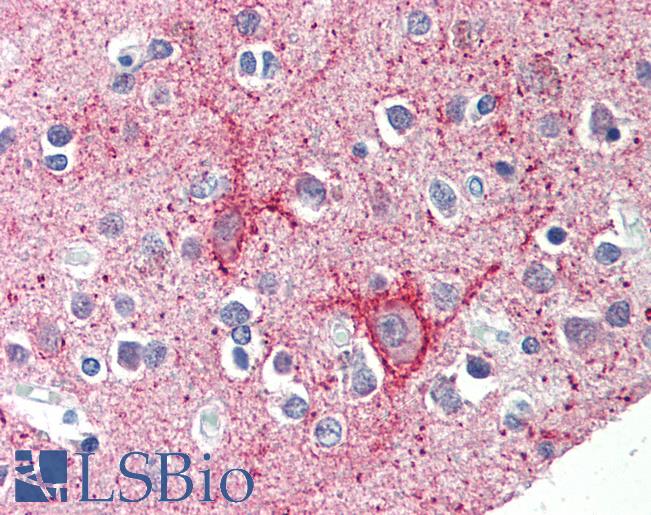 Anti-C12orf5 / TIGAR antibody IHC of human brain, cortex. Immunohistochemistry of formalin-fixed, paraffin-embedded tissue after heat-induced antigen retrieval. Antibody LS-B462 concentration 5 ug/ml.