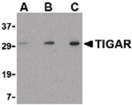 Western blot of TIGAR in EL4 cell lysate with TIGAR antibody at (A) 0.5, (B) 1 and (C) 2 ug/ml.