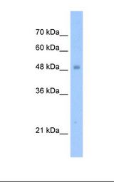 Jurkat cell lysate. Antibody concentration: 1.25 ug/ml. Gel concentration: 12%.