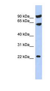 TIGD3 antibody LS-C111217 Western blot of PANC1 cell lysate.