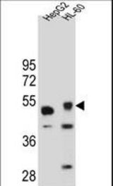 TIGD3 Antibody western blot of HepG2 and HL-60 cell line lysates (35 ug/lane). The TIGD3 antibody detected the TIGD3 protein (arrow).