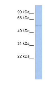 TIGD4 antibody LS-C111439 Western blot of HepG2 cell lysate.