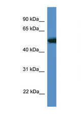 TIGD4 antibody LS-C135291 Western blot of Mouse Heart lysate. Antibody concentration 1 ug/ml.
