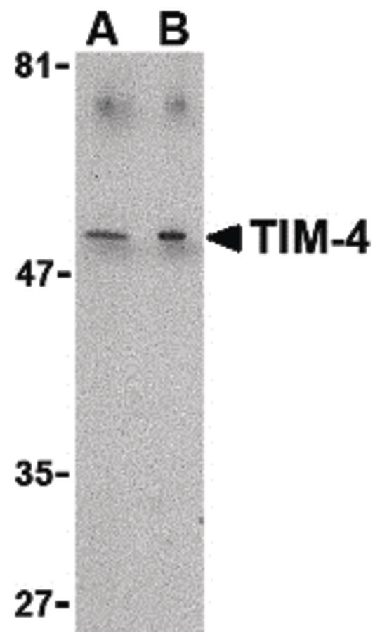 Western blot of TIM-4 in Jurkat lysate with TIM-4 antibody at (A) 1 and (B) 2 ug/ml.