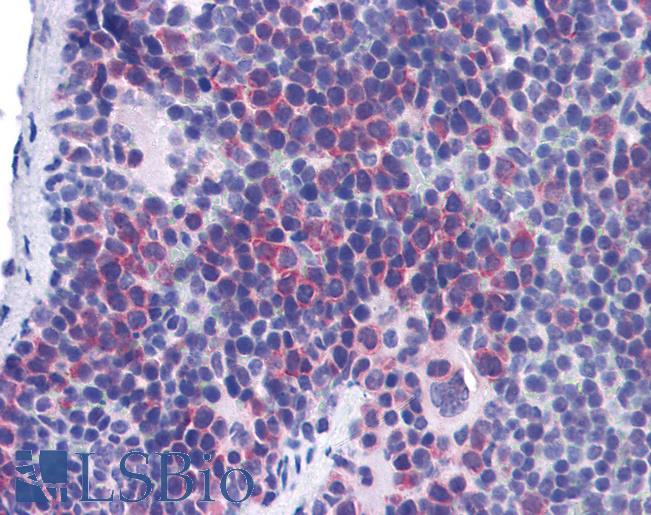 Anti-TIMD4 / TIM4 antibody IHC of mouse spleen. Immunohistochemistry of formalin-fixed, paraffin-embedded tissue after heat-induced antigen retrieval. Antibody LS-B1413 concentration 5 ug/ml.