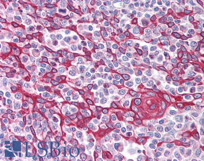 Anti-TIMD4 / TIM4 antibody IHC of human thymus. Immunohistochemistry of formalin-fixed, paraffin-embedded tissue after heat-induced antigen retrieval. Antibody LS-B1413 concentration 5 ug/ml.