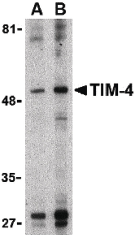 Western blot of TIM-4 in Jurkat lysate with TIM-4 antibody at (A) 1 and (B) 2 ug/ml.