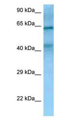 TIMD4 / TIM4 / TIM-4 antibody Western Blot of 293T.