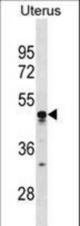 TIMD4 Antibody western blot of human Uterus tissue lysates (35 ug/lane). The TIMD4 antibody detected the TIMD4 protein (arrow).
