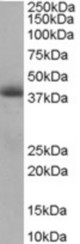 Antibody staining (0.5 ug/ml) of Human Heart lysate (RIPA buffer, 35 ug total protein per lane). Primary incubated for 1 hour. Detected by Western blot of chemiluminescence.