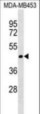 TIMM50 Antibody western blot of MDA-MB453 cell line lysates (35 ug/lane). The TIMM50 antibody detected the TIMM50 protein (arrow).