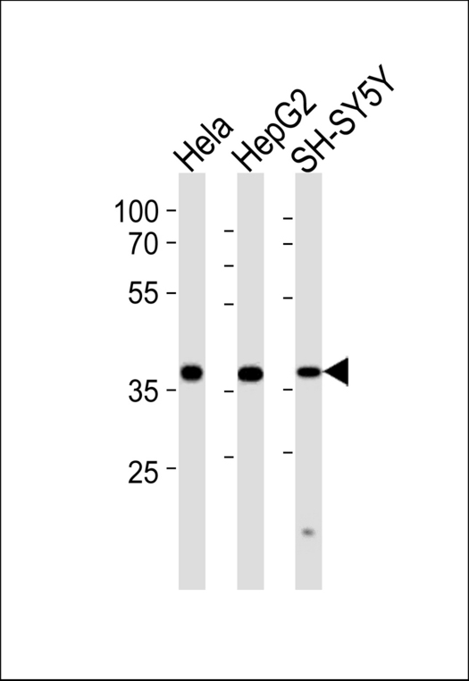 Western blot of lysates from HeLa, HepG2, SH-SY5Y cell line (from left to right) with TIMM50 Antibody. Antibody was diluted at 1:1000 at each lane. A goat anti-rabbit IgG H&L (HRP) at 1:5000 dilution was used as the secondary antibody. Lysates at 35 ug per lane.