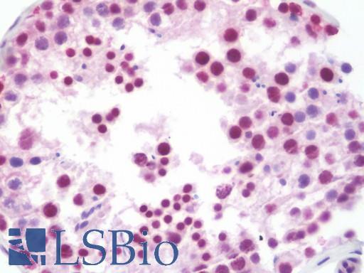 Anti-TIMP1 antibody IHC staining of human testis. Immunohistochemistry of formalin-fixed, paraffin-embedded tissue after heat-induced antigen retrieval. Antibody LS-B10535 dilution 1:100.