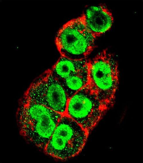 Confocal immunofluorescent of TIMP1 Antibody with A2058 cell followed by Alexa Fluor 488-conjugated goat anti-rabbit lgG (green). Actin filaments have been labeled with Alexa Fluor 555 phalloidin (red).