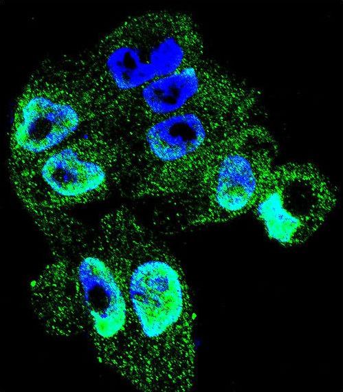 Confocal immunofluorescent of TIMP1 Antibody with A2058 cell followed by Alexa Fluor 488-conjugated goat anti-rabbit lgG (green). DAPI was used to stain the cell nuclear (blue).