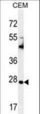 TIMP1 Antibody western blot of CEM cell line lysates (35 ug/lane). The TIMP1 antibody detected the TIMP1 protein (arrow).