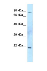 TIMP2 antibody LS-C145866 Western blot of Mouse Thymus lysate. Antibody concentration 1 ug/ml.