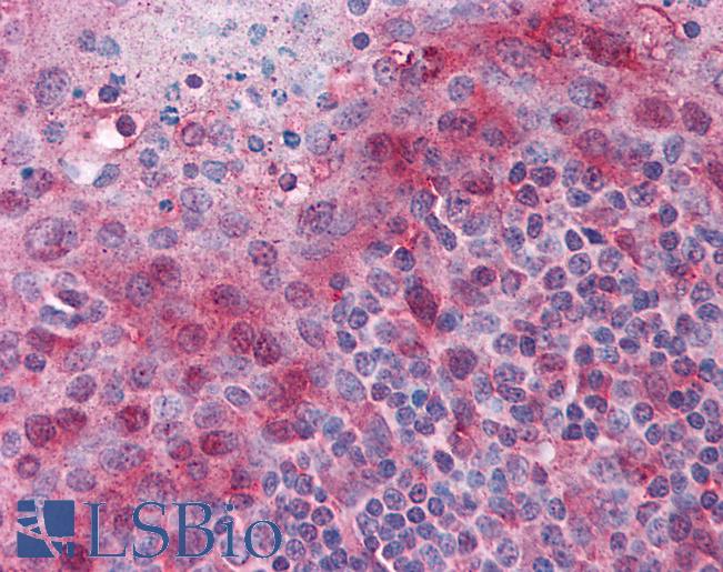 Anti-PYCARD antibody IHC of human tonsil. Immunohistochemistry of formalin-fixed, paraffin-embedded tissue after heat-induced antigen retrieval. Antibody LS-B4431 concentration 2.5 ug/ml.