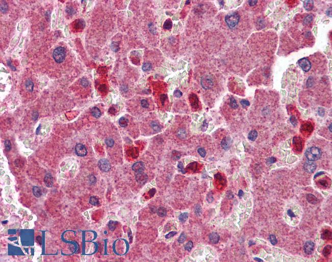 Anti-PYCARD antibody IHC of human liver. Immunohistochemistry of formalin-fixed, paraffin-embedded tissue after heat-induced antigen retrieval. Antibody LS-B4431 concentration 2.5 ug/ml.