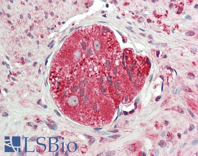 Human Colon, Myenteric Plexus: Formalin-Fixed, Paraffin-Embedded (FFPE)
