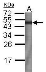 Anti-TIMP3 antibody used in Western blot at 1:30000 dilution to detect 100ng of 50kDa recombinant TIMP3 protein antigen.
