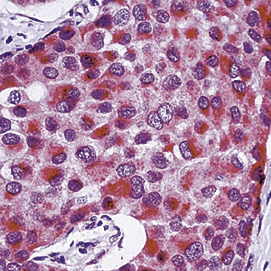 Formalin-fixed, paraffin-embedded human testis stained with TIMP-3 antibody LS-C95907.