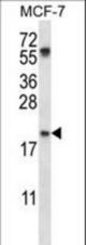 PYCARD Antibody western blot of MCF-7 cell line lysates (35 ug/lane). The PYCARD antibody detected the PYCARD protein (arrow).