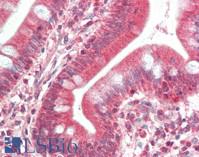 Anti-TIMP4 antibody IHC staining of human small intestine. Immunohistochemistry of formalin-fixed, paraffin-embedded tissue after heat-induced antigen retrieval. Antibody LS-B10594 concentration 10 ug/ml.