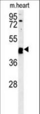 TINAGL1 Antibody western blot of mouse heart tissue lysates (15 ug/lane). The TINAGL1 antibody detected TINAGL1 protein (arrow).
