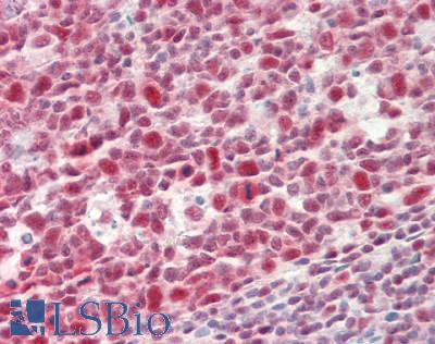 Human Tonsil: Formalin-Fixed, Paraffin-Embedded (FFPE)
