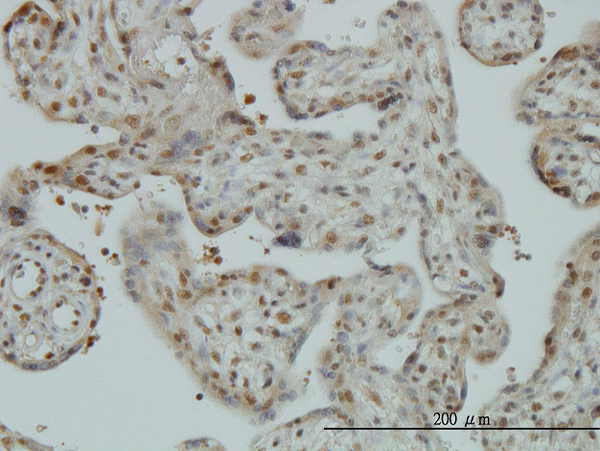 Immunoperoxidase of monoclonal antibody to CAND1 on formalin-fixed paraffin-embedded human placenta. [antibody concentration 3 ug/ml]