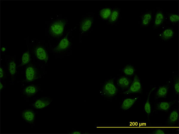 Immunofluorescence of monoclonal antibody to CAND1 on HeLa cell. [antibody concentration 10 ug/ml]