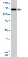 CAND1 monoclonal antibody (M01), clone 5D7 Western blot of CAND1 expression in HeLa NE.