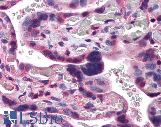 Anti-CAND1 antibody IHC of human placenta. Immunohistochemistry of formalin-fixed, paraffin-embedded tissue after heat-induced antigen retrieval. Antibody LS-B5610 concentration 5 ug/ml.