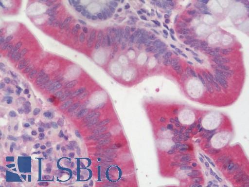 Anti-TIP30 / HTATIP2 antibody IHC staining of human small intestine. Immunohistochemistry of formalin-fixed, paraffin-embedded tissue after heat-induced antigen retrieval. Antibody LS-B10900 concentration 5 ug/ml.